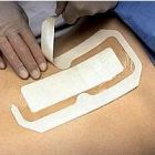 Tegaderm+pad transparent stérile avec compresse absorbante 3M 3584 6 cm x 10 cm par boite de 50